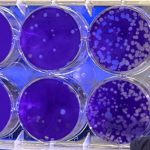 Coronavirus (COVID-19) Q&A